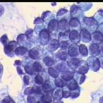 Ομάδα κυττάρων ενδοτραχήλου. 